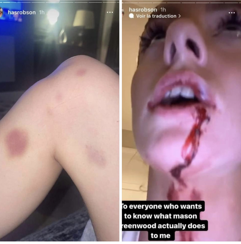 Le footballeur anglais Mason Greenwood accusé de viol et violence par sa compagne, images et enregistrements audios à l'appui Le footballeur anglais Mason Greenwood accusé de viol et violence par sa compagne, images et enregistrements audios à l'appui