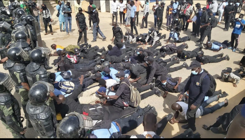 Répression des manifestations des Asp: l’un d’entre eux perd tous ses doigts à Ziguinchor Répression des manifestations des Asp: l’un d’entre eux perd tous ses doigts à Ziguinchor