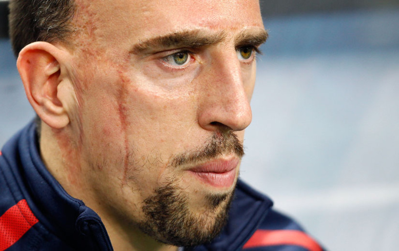 Franck Ribéry : opéré d'un hématome aux fessiers Franck Ribéry : opéré d'un hématome aux fessiers