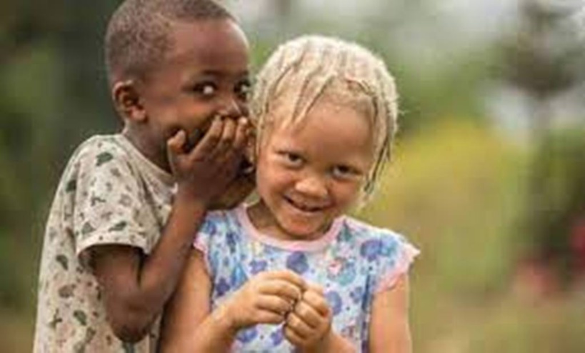  Sénégal : les albinos se disent être victimes de discrimination et interpellent les autorités Sénégal : les albinos se disent être victimes de discrimination et interpellent les autorités