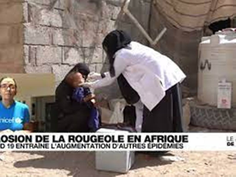 L'Afrique particulièrement touchée par l'explosion des cas de rougeole