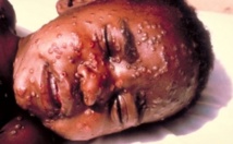 Ebola : l'UE porte à 720 millions FCFA son aide à l'Afrique de l'Ouest Ebola : l'UE porte à 720 millions FCFA son aide à l'Afrique de l'Ouest