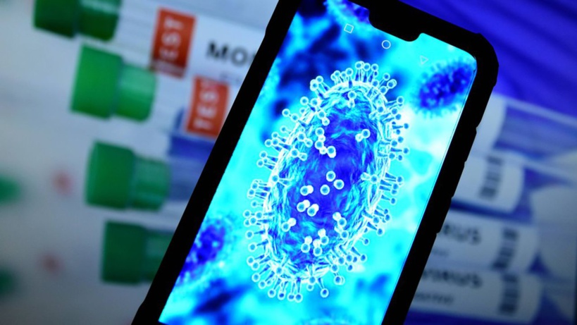 Espagne: deuxième décès d'un patient contaminé par la variole du singe Espagne: deuxième décès d'un patient contaminé par la variole du singe