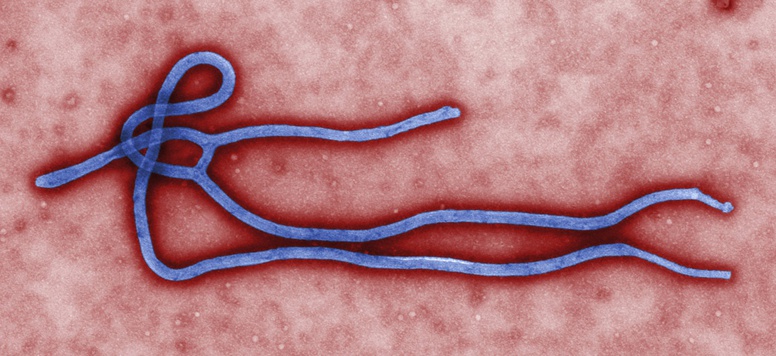 Ebola: l'espoir d'un vaccin disponible dès 2015 semble malheureusement improbable