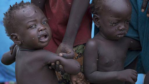 50.000 enfants de moins de cinq ans risquent de mourir du fait de la malnutrition