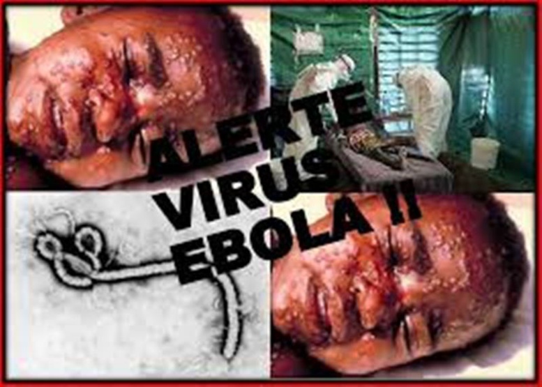 LIVETWEET- Ebola: Suivre l'évolution de l'épidémie à la minute LIVETWEET- Ebola: Suivre l'évolution de l'épidémie à la minute