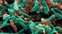 Des bactéries de la tuberculose pourraient être vite détectées