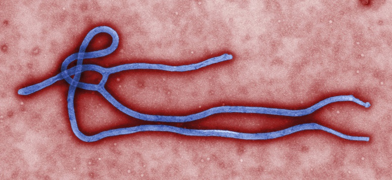 Ebola: tests cliniques pour les vaccins expérimentaux