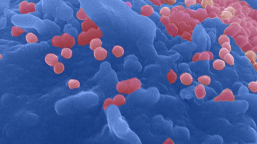 Ces constats représentent une piste pour la guérison, selon les chercheurs.