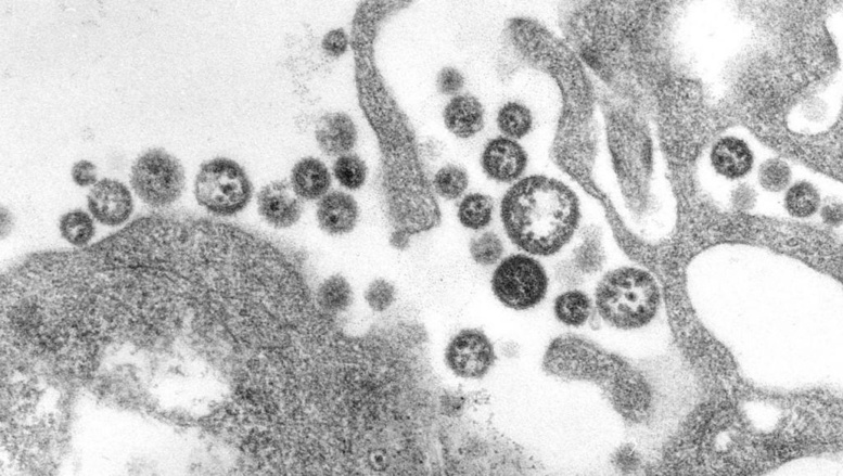 Microscopie électronique en transmission montrant des virus de Lassa à côté de débris cellulaires. Wikipedia