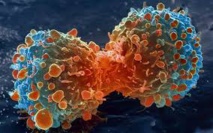 ​« Le cancer est un fardeau mondial », secrétaire général du MSA