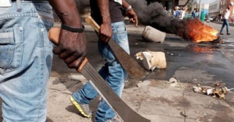 Mamoune Sarr blessé dans les violences xénophobes en Afrique du Sud Mamoune Sarr blessé dans les violences xénophobes en Afrique du Sud