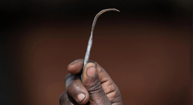 L'Unicef déplore plus de 230 millions de victimes de mutilations génitales dans le monde L'Unicef déplore plus de 230 millions de victimes de mutilations génitales dans le monde