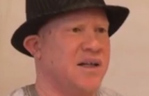 Bamba Diop,président de l'Association nationale des albinos du Sénégal Bamba Diop,président de l'Association nationale des albinos du Sénégal