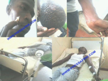 PHOTOS UCAD: cinq blessés gisent au service médical