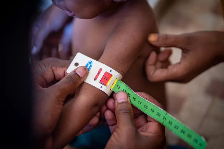 ​Lutte contre la malnutrition: Matam toujours dans la zone rouge