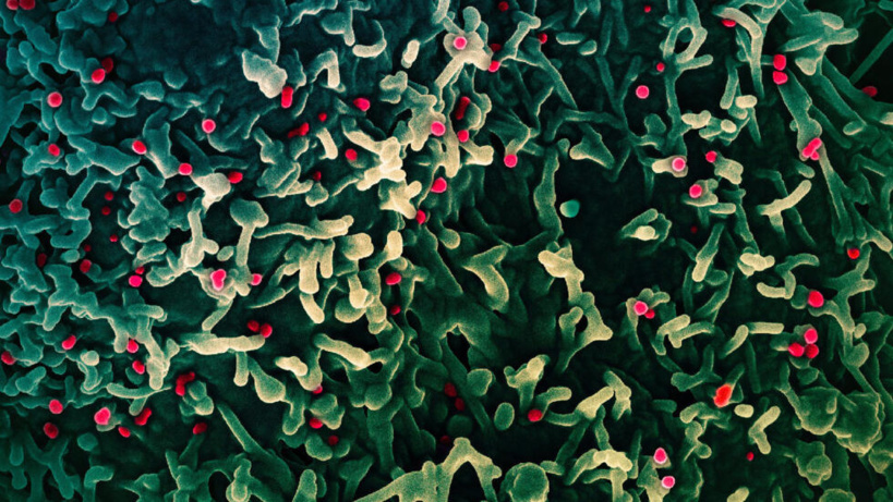 Variole du singe en Afrique: l'OMS va réunir son comité d'urgence Variole du singe en Afrique: l'OMS va réunir son comité d'urgence