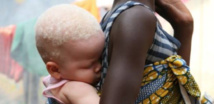 UN HOMME ARRÊTÉ POUR AVOIR TENTÉ DE VENDRE SA PETITE AMIE ALBINOS