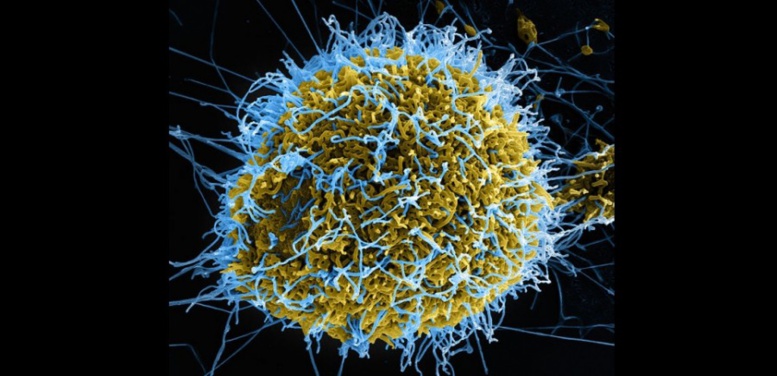 Attention : les « guéris » d’Ebola sont-ils réellement guéris ?