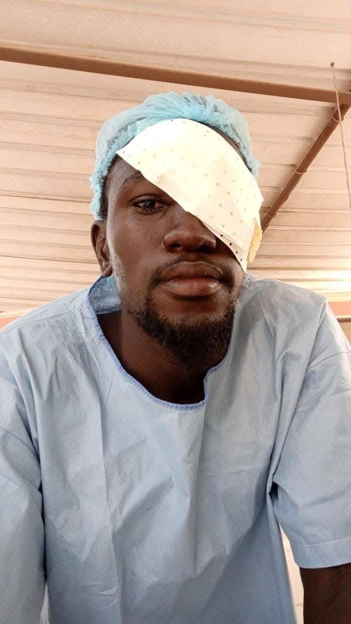 Affrontement à l'Université Iba Der Thiam: L’étudiant Mady Ndiaye perd un œil