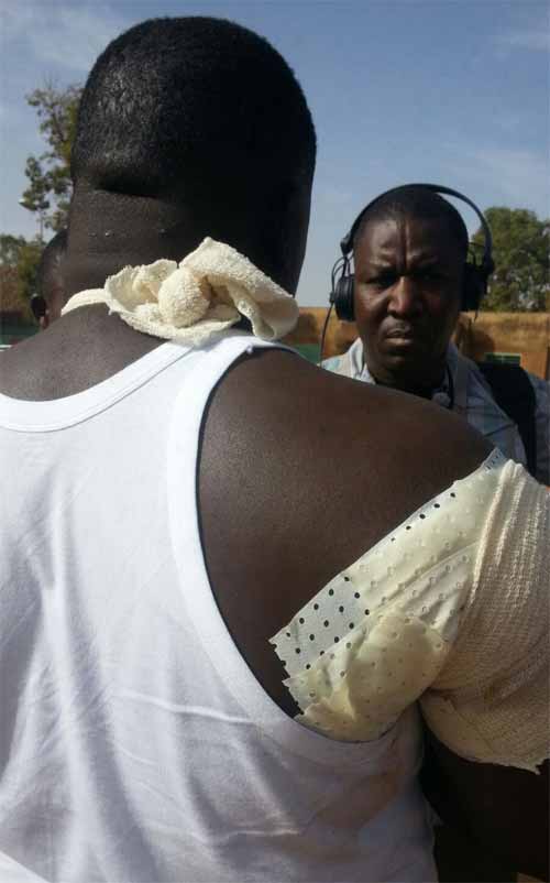 ​Attaques au Burkina Faso : témoignages d’un blessé évacué à Yalgado