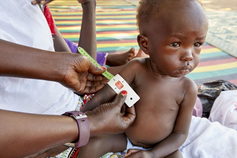 Soudan : la malnutrition infantile gagne du terrain Soudan : la malnutrition infantile gagne du terrain