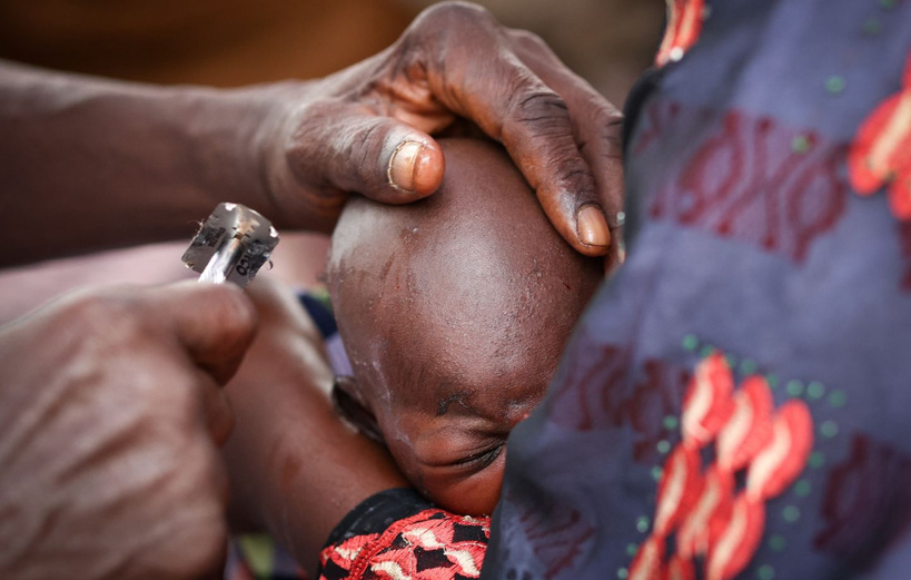 Gambie : décès d’un nourrisson féminin âgé d’un mois après une excision Gambie : décès d’un nourrisson féminin âgé d’un mois après une excision