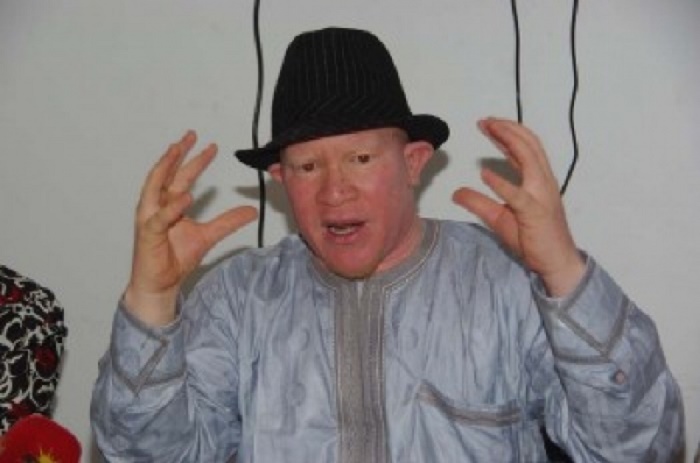 Mouhamadou Bamba Diop : «Je me demande si les albinos ne doivent pas quitter le Sénégal».