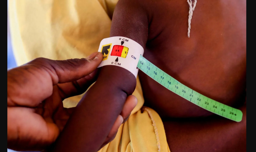 Malnutrition infantile : le Sénégal face au défi persistant du retard de croissance Malnutrition infantile : le Sénégal face au défi persistant du retard de croissance