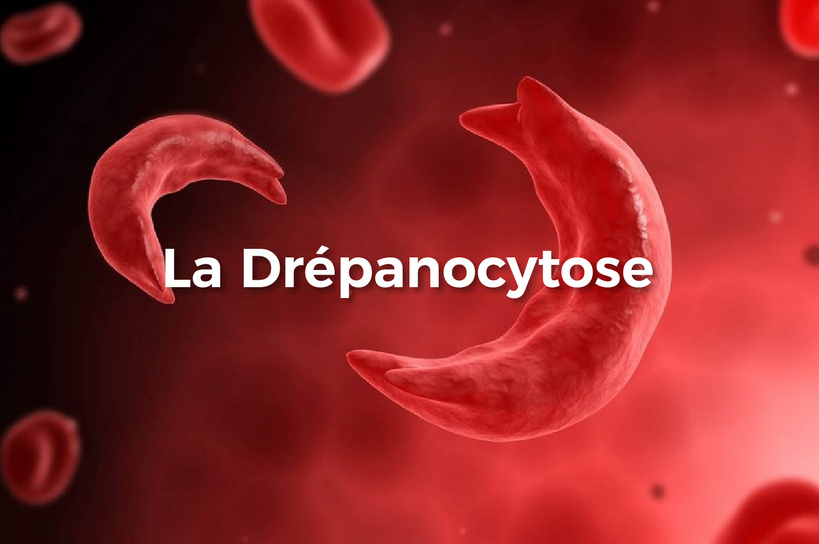 Drépanocytose à Kolda : plus de 250 enfants suivis et un traitement à vie inaccessible pour les familles Drépanocytose à Kolda : plus de 250 enfants suivis et un traitement à vie inaccessible pour les familles