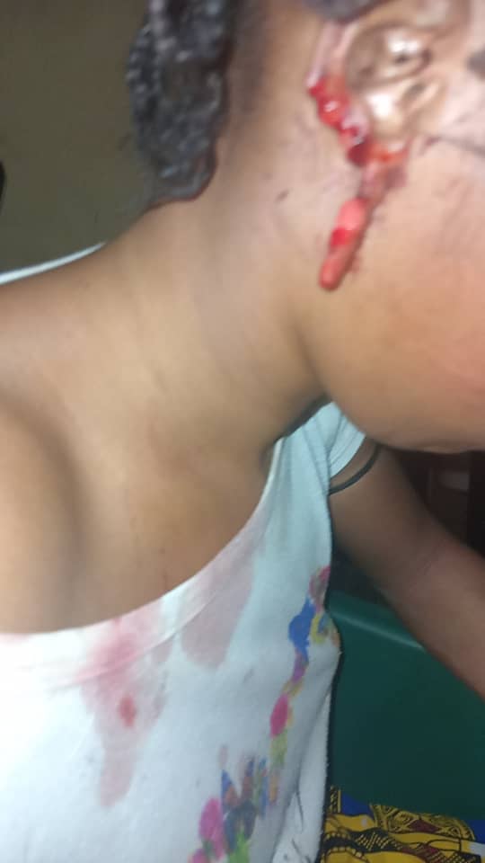Médina Fodé : l'oreille d'une jeune femme sectionnée lors d'une altercation avec sa belle-famille, la victime a porté plainte