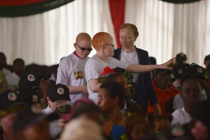 Kenya : Les albinos ont leur concours de beauté pour lutter contre les préjugés