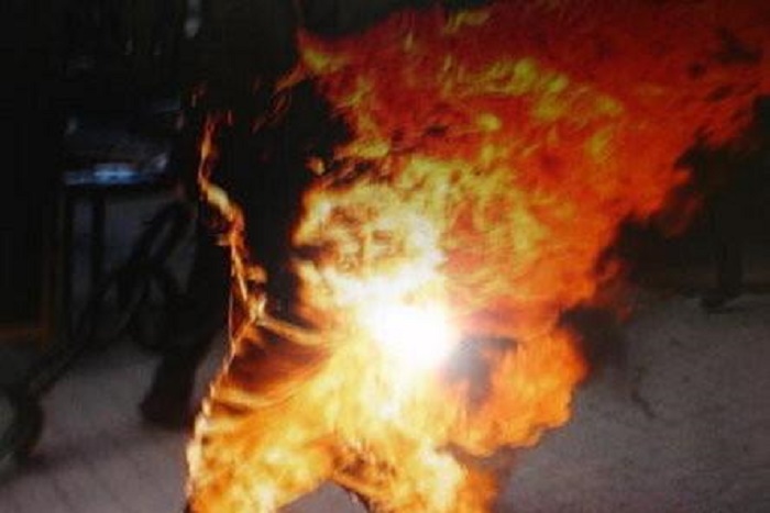 Diourbel : Une prostituée succombe après s’être immolée par le feu