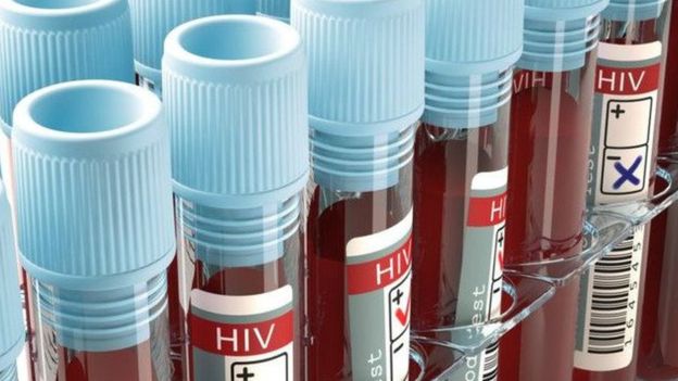 Congo : rupture des antirétroviraux