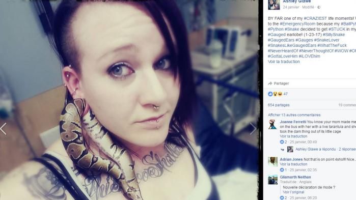 Etats-Unis : elle termine aux urgences à cause d'un serpent coincé dans son oreille