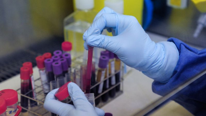 ​Sida: des chercheurs français font une avancée majeure