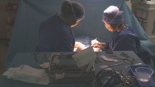 Afrique du Sud : 3ème greffe réussie du pénis