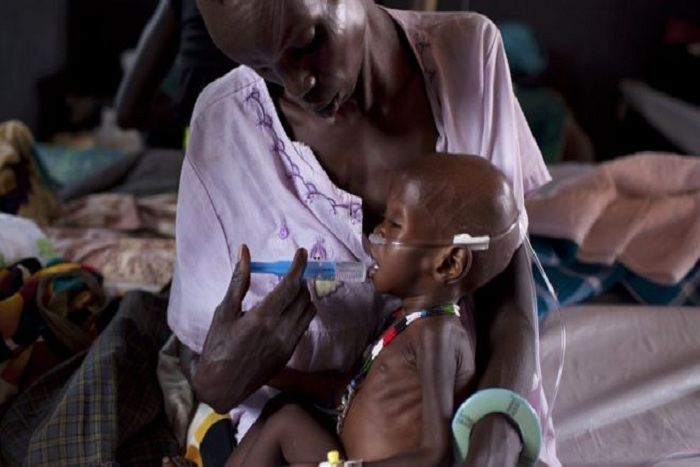 Soudan : 250 enfants morts de diarrhée