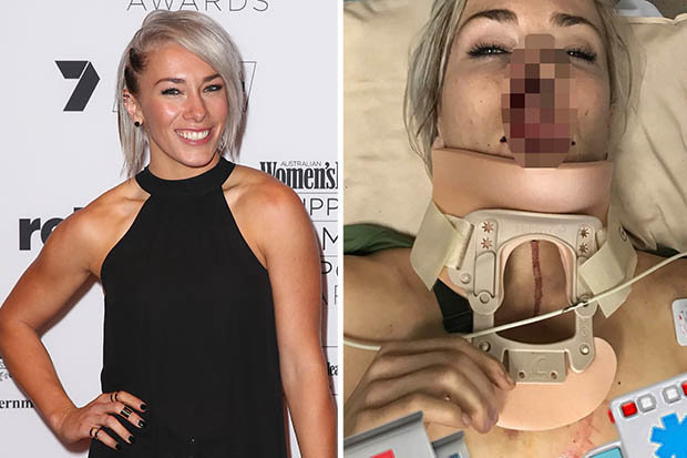 La championne du monde de BMX Caroline Buchanan fait un grave accident