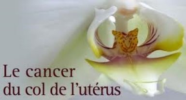 Le Cancer du sein et du col de l’utérus cause 10 millions de décès par an (Spécialiste)