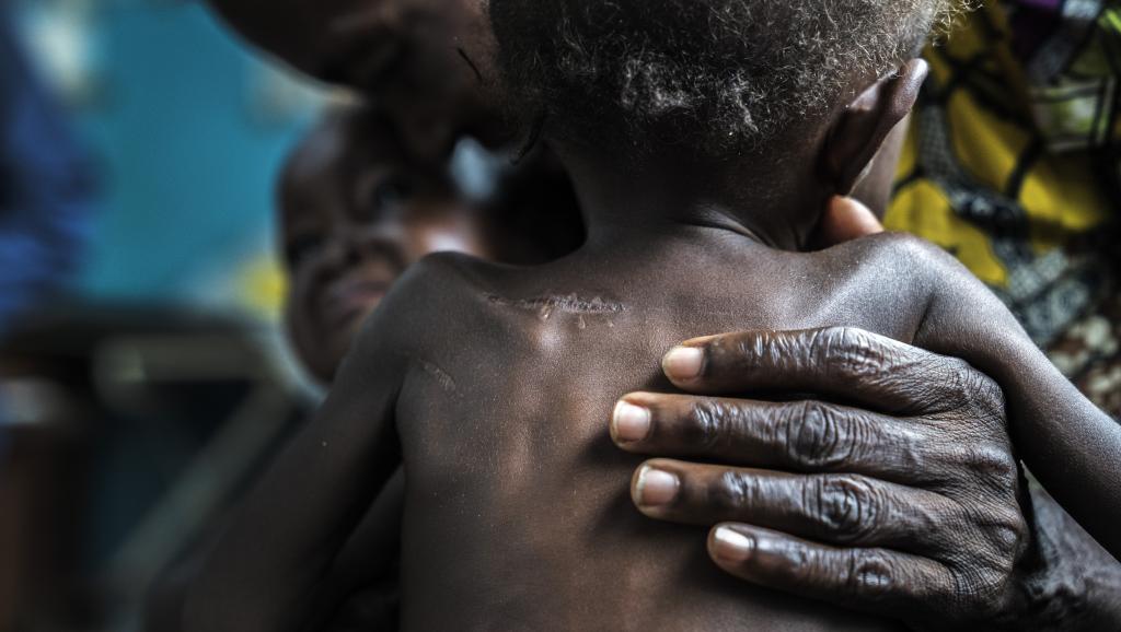 ​RDC: des ONG appellent à une aide d'urgence pour les populations du Kasaï