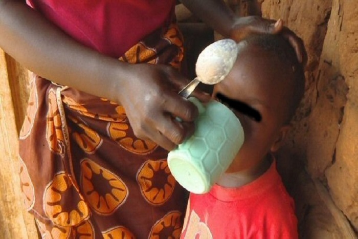 Sédhiou : 30% des enfants frappés de malnutrition