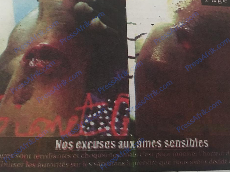 ​Charcutée par sa coépouse, la victime raconte l’horreur