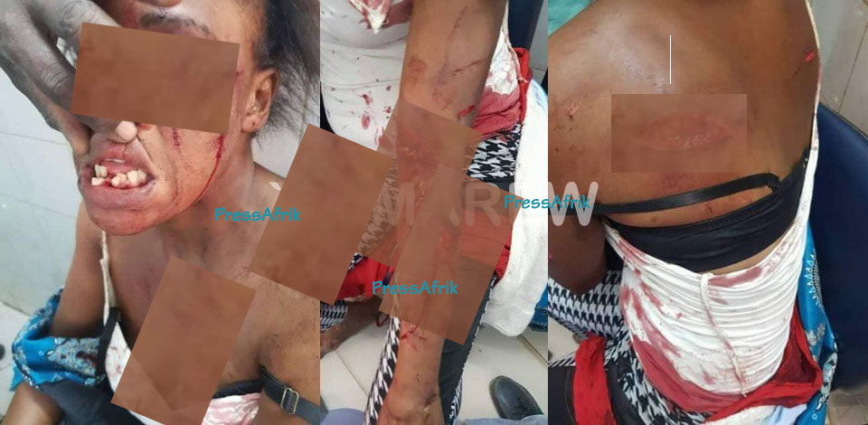 ​Touba: Une femme charcute et édente sa coépouse (Photo à éviter par les âmes sensibles)