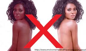 Rwanda : le Président Paul Kagamé poursuit sa campagne de répression contre la dépigmentation