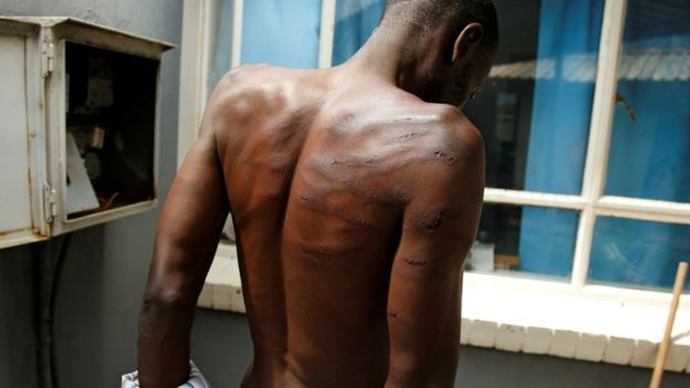 L’armée zimbabwéenne accusée de 'torture systématique' sur des manifestants.