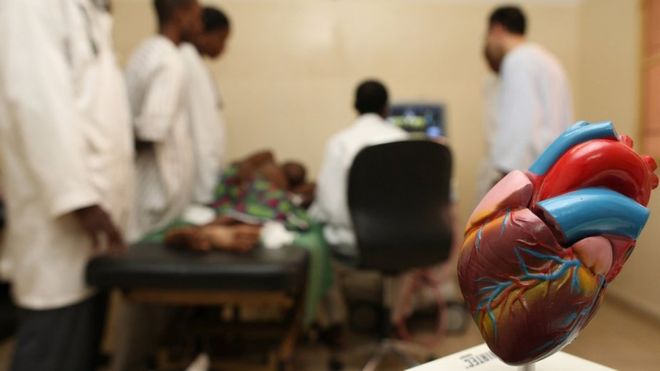 Détester votre patron pourrait vous tuer