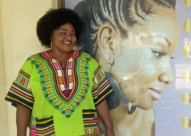 Alopécie: une femme devient chauve en Afrique du Sud