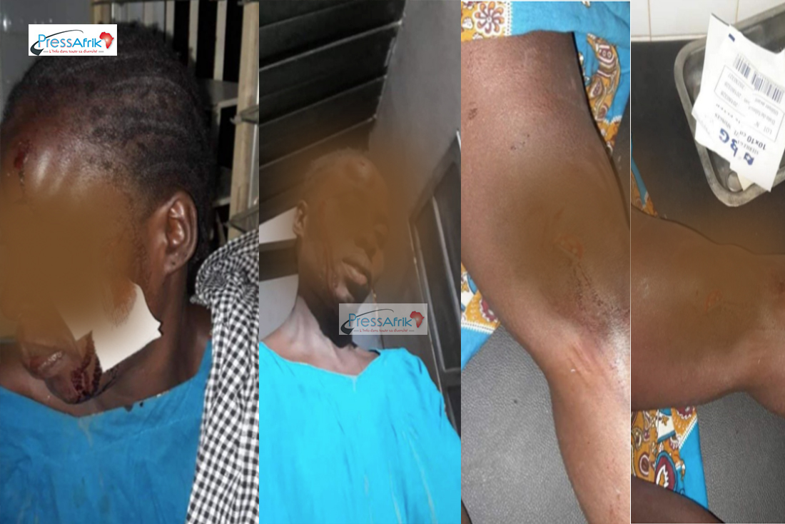 ​Département Mbour: le Chef de poste Vétérinaire de Nguéniène agressé par des voleurs (Photo)