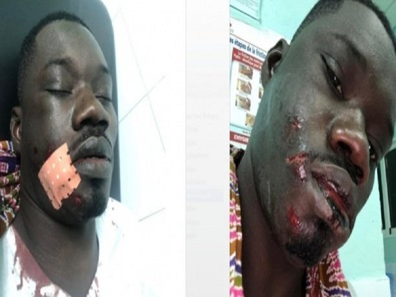 Du nouveau dans l’agression de Guin Thieuss : le parquet ouvre une information judiciaire